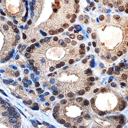 Human c-Myc Antibody, R D Systems 100ug; Unlabeled:Antibodies, Monoclonal