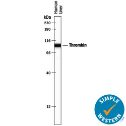 Human Coagulation Factor II/Thrombin Antibody, R D Systems 100&mu;g; Unlabeled:Antibodies,