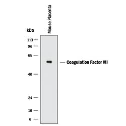 Mouse Coagulation Factor VII Antibody, R D Systems 100 &mu;g | Buy Online | R&D Systems | Fisher Scientific