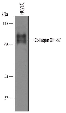Human Collagen XIII alpha 1 Antibody, R D Systems 25&mu;g; Unlabeled:Antistoffer