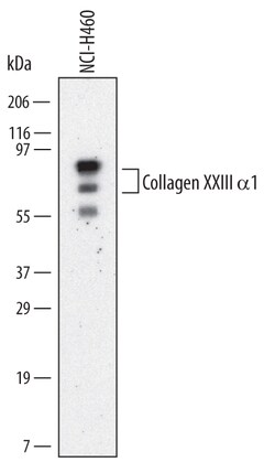 Human Collagen XXIII alpha 1 Antibody, R D Systems 25 &mu;g | Buy Online | R&D Systems | Fisher Scientific