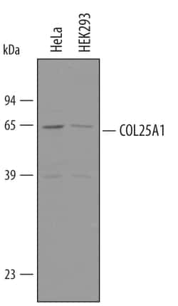 Human Collagen XXV alpha 1 Antibody, R D Systems 25&mu;g; Unlabeled:Antibodies,