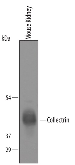 Mouse Collectrin Antibody, R D Systems 25&mu;g; Unlabeled:Antibodies, Polyclonal