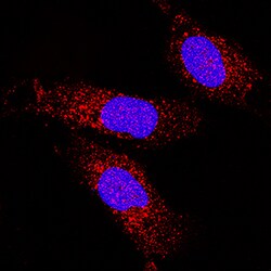 Human COMMD1 Antibody, R D Systems 25&mu;g; Unlabeled:Antibodies, Monoclonal