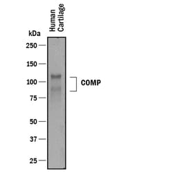 Human COMP/Thrombospondin-5 Antibody, R D Systems 25&mu;g; Unlabeled:Antibodies,