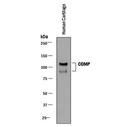 Human COMP/Thrombospondin-5 Antibody, R D Systems 100ug; Unlabeled:Antibodies,