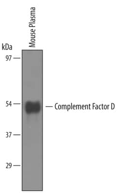 Mouse Complement Factor D/Adipsin Antibody, R D Systems 100&mu;g; Unlabeled:Antibodies,