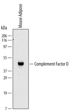 Mouse Complement Factor D/Adipsin Antibody, R D Systems 100ug; Unlabeled:Antibodies,