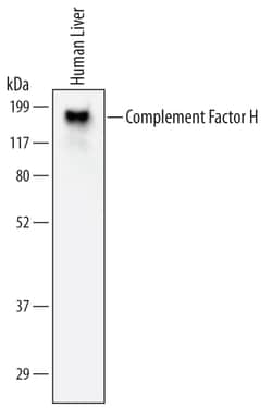 Human Complement Factor H Antibody, R D Systems 25&mu;g; Unlabeled:Antibodies,