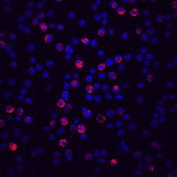 Human Complement Factor H-related 4/ CFHR4 Antibody, R D Systems 100ug;