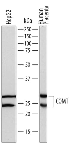 Human COMT Antibody, R D Systems 25&mu;g; Unlabeled:Antibodies, Polyclonal
