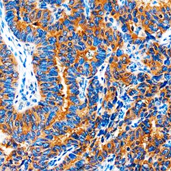 Human COX-2 Antibody, R D Systems 100ug; Unlabeled:Antibodies, Monoclonal