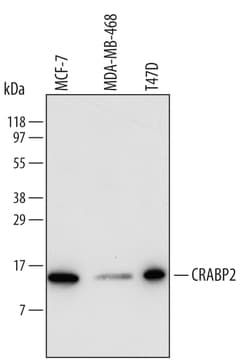 Human CRABP2 Antibody, R D Systems 100&mu;g; Unlabeled:Antibodies, Polyclonal