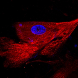 Human C-Reactive Protein/CRP Antibody, R D Systems 25 &mu;g | Buy Online | R&D Systems | Fisher Scientific
