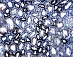 Human C-Reactive Protein/CRP Antibody, R D Systems 25 &mu;g | Buy Online | R&D Systems | Fisher Scientific