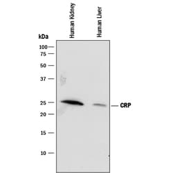 Human C-Reactive Protein/CRP Antibody, R D Systems 25 &mu;g | Buy Online | R&D Systems | Fisher Scientific