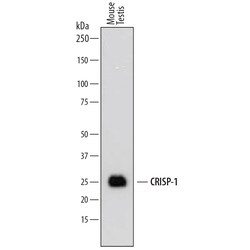 Mouse CRISP-1 Antibody, R D Systems 25&mu;g; Unlabeled:Antibodies, Polyclonal