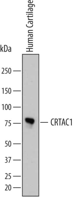 Human CRTAC1 Antibody, R D Systems 100ug; Unlabeled:Antibodies, Monoclonal