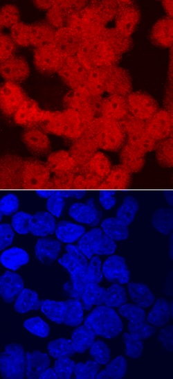 Human CRX Antibody, R D Systems 100&mu;g; Unlabeled:Antibodies, Polyclonal