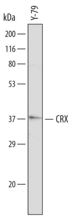 Human CRX Antibody, R D Systems 100&mu;g; Unlabeled:Antibodies, Polyclonal
