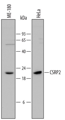 Human CSRP2 Antibody, R D Systems 25&mu;g; Unlabeled:Antibodies, Polyclonal