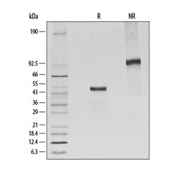 R D Systems Recombinant Human CTLA-4 Fc Chimera His-tag Protein, CF 200 &mu;g | Buy Online | R&amp;D Systems&trade; | Fisher Scientific