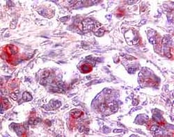 Human CX3CL1/Fractalkine Chemokine Domain Antibody, R D Systems 100&mu;g;