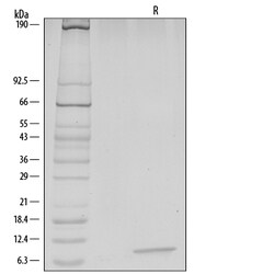 R D Systems Recombinant Human/Rhesus Macaque/Feline CXCL12/SDF-1 alpha 50 &mu;g | Buy Online | R&amp;D Systems&trade; | Fisher Scientific