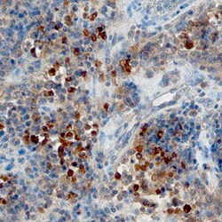 Human CXCL13/BLC/BCA-1 Antibody, R D Systems 25&mu;g; Unlabeled:Antibodies,