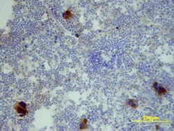 Mouse CXCL2/GRO beta/MIP-2/CINC-3 Biotinylated Antibody, R D Systems 50&mu;g;