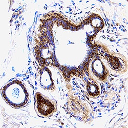Human CXCL5/ENA-78 Antibody, R D Systems 100&mu;g; Unlabeled:Antibodies,