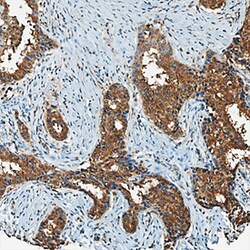 Human CXCL5/ENA-78 Antibody, R D Systems 100&mu;g; Unlabeled:Antibodies,