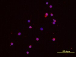Human IL-8/CXCL8 Antibody, R D Systems 100&mu;g; Unlabeled:Antibodies,