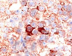 Human CXCR2/IL-8RB Antibody, R D Systems 100ug; Unlabeled:Antibodies, Monoclonal