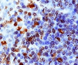 Human CXCR4 Antibody, R D Systems 100ug; Unlabeled:Antibodies, Monoclonal