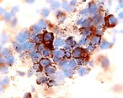 Human CXCR4 Antibody, R D Systems 100ug; Unlabeled:Antibodies, Monoclonal