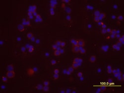 Mouse CXCR4 Antibody, R D Systems 100ug; Unlabeled:Antibodies, Monoclonal