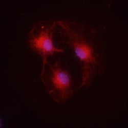 Mouse CXCR4 Antibody, R D Systems 100ug; Unlabeled:Antibodies, Monoclonal