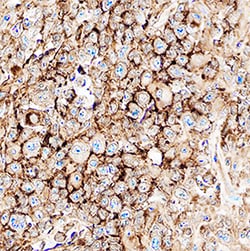 Human CXCR5 Antibody, R D Systems 100 &mu;g | Buy Online | R&D Systems | Fisher Scientific