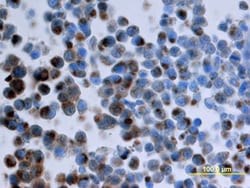 Human CXCR7/RDC-1 Antibody, R D Systems 100ug; Unlabeled:Antibodies, Monoclonal