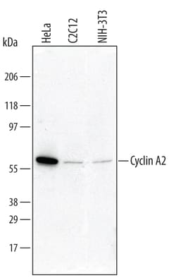 Human/Mouse Cyclin A2 Antibody, R D Systems 100&mu;g; Unlabeled:Antibodies,