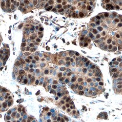 Human Cyclin E1 Antibody, R D Systems 25&mu;g; Unlabeled:Antibodies, Polyclonal