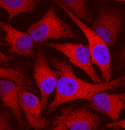 Human/Mouse/Rat Cyclophilin B Antibody, R D Systems 100ug; Unlabeled:Antibodies,