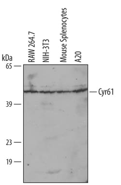 Mouse Cyr61/CCN1 Antibody, R D Systems 100 &mu;g | Buy Online | R&D Systems | Fisher Scientific
