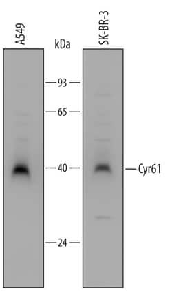 Human Cyr61/CCN1 Antibody, R D Systems 100&mu;g; Unlabeled:Anticuerpos