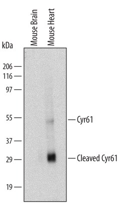 Mouse Cyr61/CCN1 Antibody, R D Systems 100 &mu;g | Buy Online | R&D Systems | Fisher Scientific