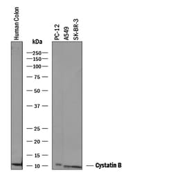 Human/Rat Cystatin B Antibody, R D Systems 25&mu;g; Unlabeled:Antibodies,