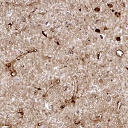 Rat Cystatin C Antibody, R D Systems 25&mu;g; Unlabeled:Antibodies, Monoclonal