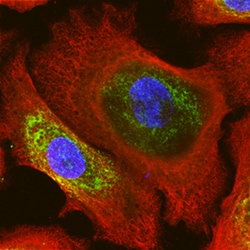 Human Cytokeratin 14 Antibody, R D Systems 25 &mu;g | Buy Online | R&D Systems | Fisher Scientific