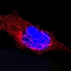 Human Cytokeratin 18 Antibody, R D Systems 100ug; Unlabeled:Antibodies,